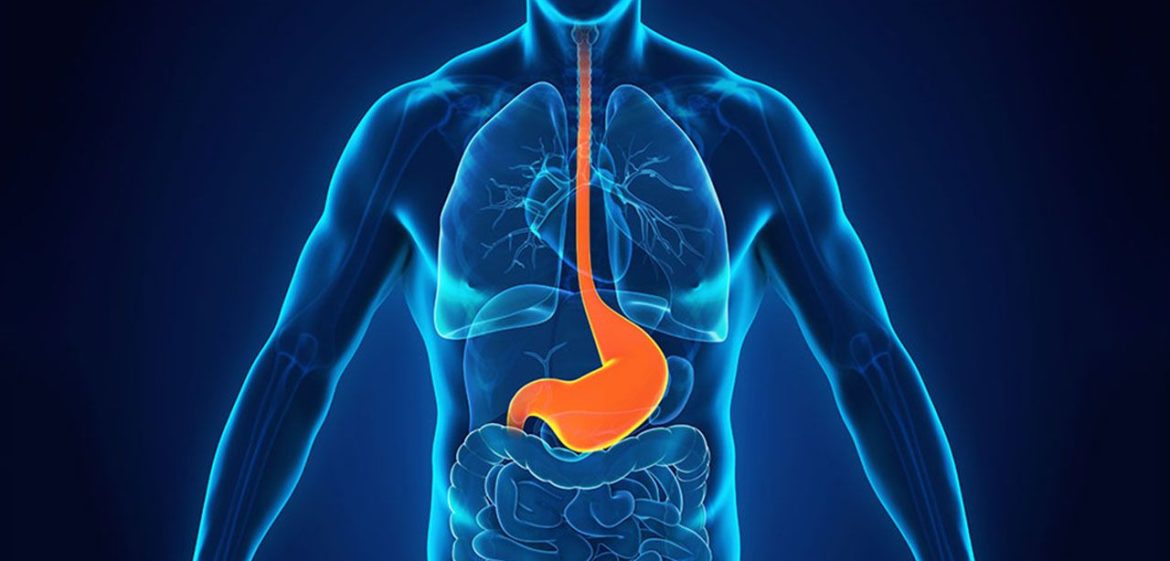 Dieta, sintomi, diagnosi, trattamendo del reflusso gastroesofageo