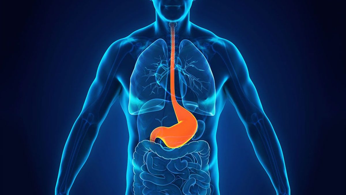 Dieta, sintomi, diagnosi, trattamendo del reflusso gastroesofageo